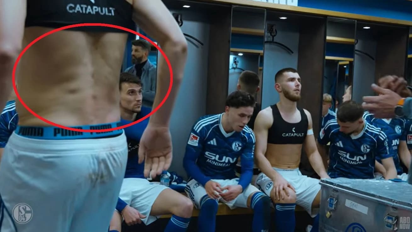 Evo kako izgledaju leđa Edina Džeke