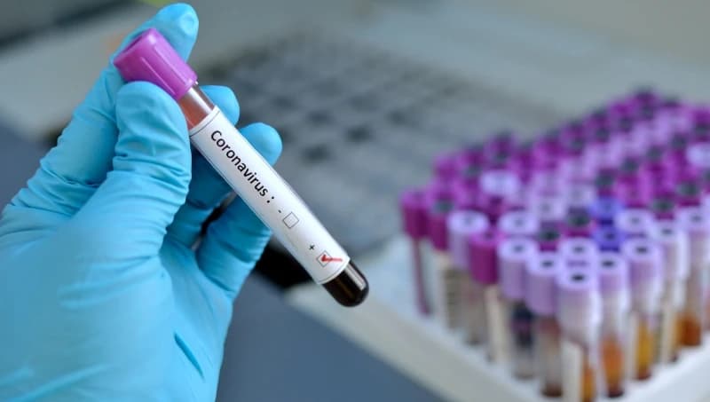Faktor saznaje: U TK urađen još jedan test na koronavirus