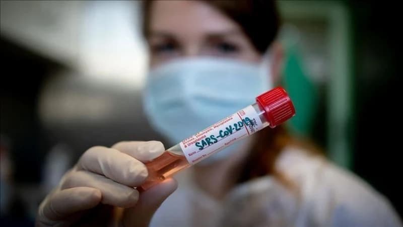 Šokantne brojke u RS-u: Umrlo 14 ljudi, koronavirusom  zaraženo još 630 osoba
