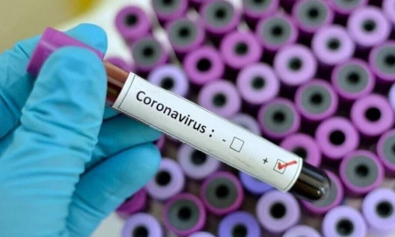 U Hrvatskoj preminule 34 osobe, 1.427 novozaraženih