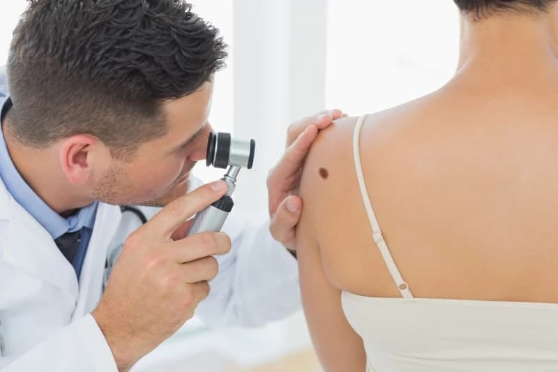 Maj se u svijetu obilježava kao mjesec svjesnosti o malignom melanomu