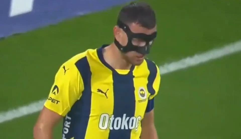 Džeko igrao sa zaštitnom maskom