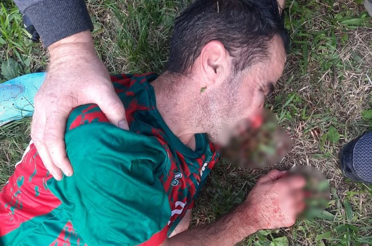 Povrijeđeni igrač NK Miri nakon žestokog obračuna sa igračima NK Stjepan Polje