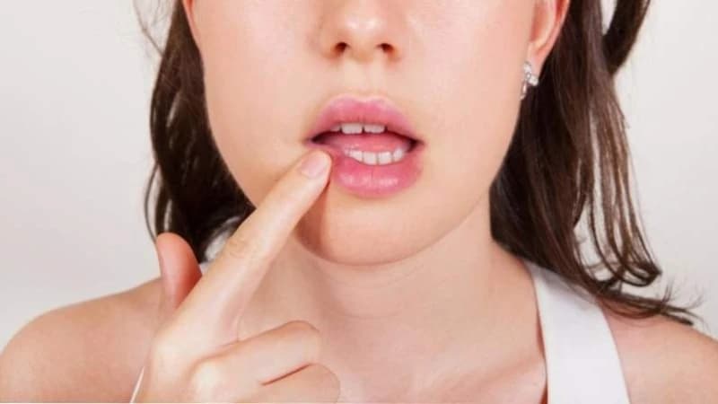 Ako vam usne stalno pucaju, možda vam nedostaje važan vitamin