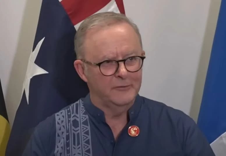 Anthony Albanese