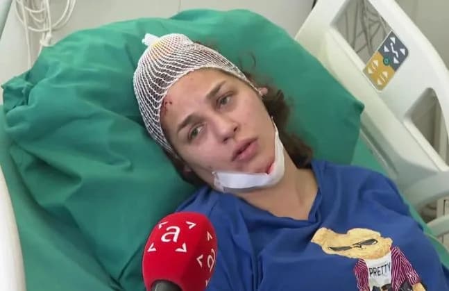 Oglasila se policija o nesreći u kojoj je učestvovala Anja Ljubojević: Bit će procesuirana u skladu sa zakonom