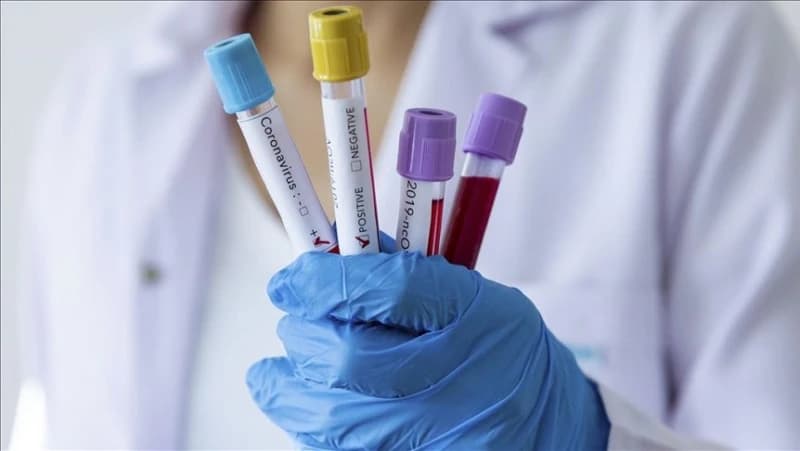 U KS za četiri dana potvrđeno 507 zaraženih koronavirusom