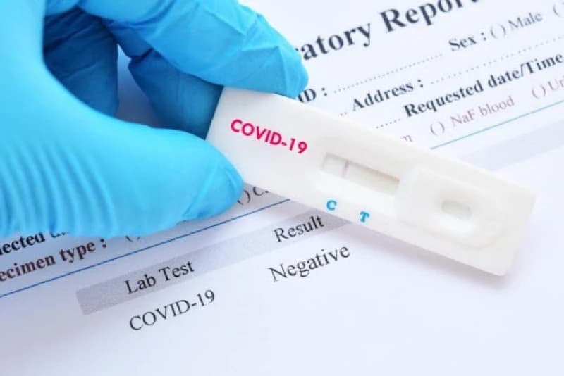 Posljednja 24 sata u BiH 474 nova slučaja COVID-19, preminulo osam osoba